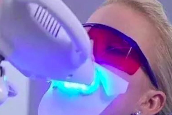 冷光美白牙齿注意事项