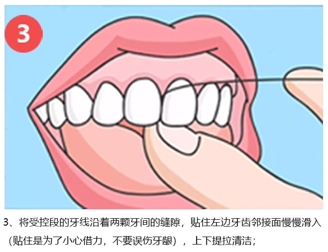 手把手教你正确用牙线，原创图解