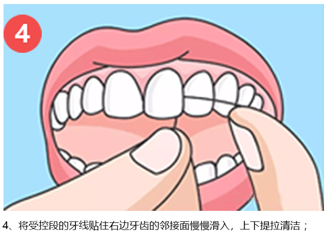 手把手教你正确用牙线，原创图解