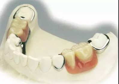 什么是固定义齿、活动义齿、种植义齿？