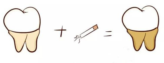 妞爸科普！洗牙到底好不好