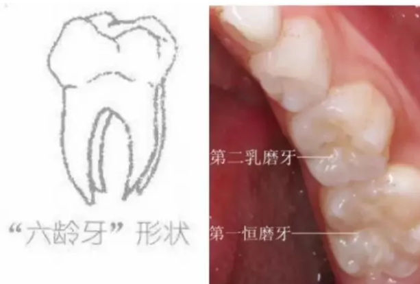 妞爸科普！到底什么是六龄牙？