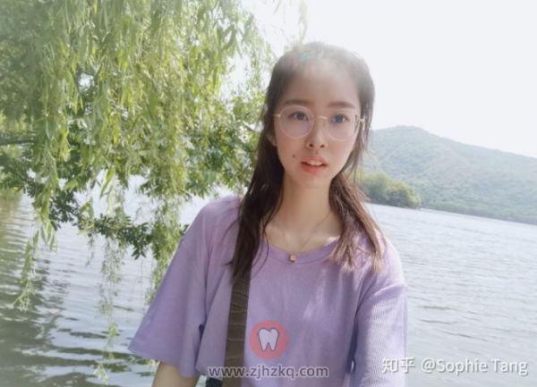 杭州隐适美正畸日记20200530