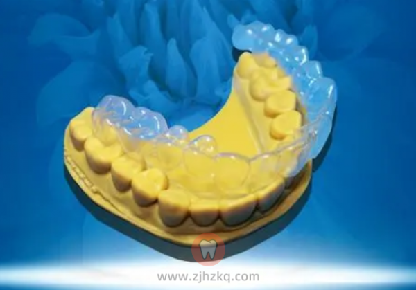 杭州牙齿隐形矫正