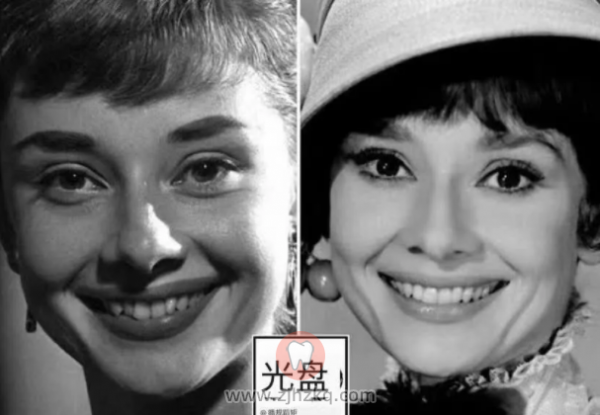 杭州善美口腔暑期正畸牙齿矫正活动0730