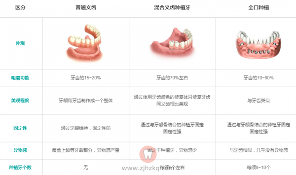种植牙假牙区别
