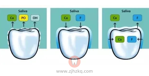 杭州儿童涂氟专题