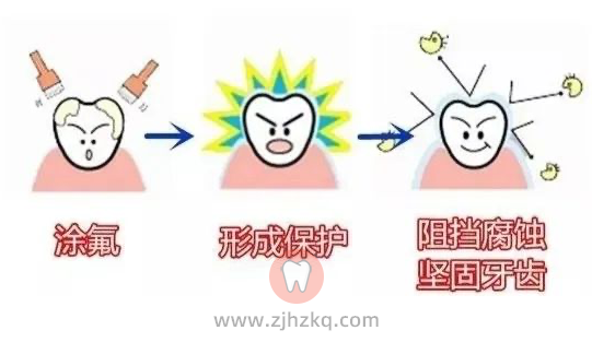 杭州儿童涂氟专题