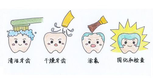 杭州儿童涂氟专题