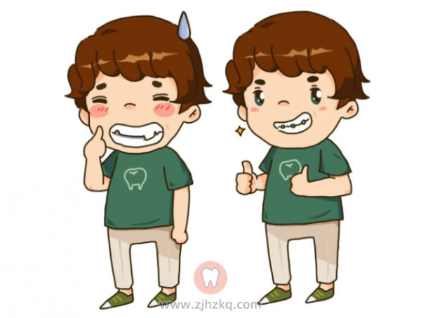 牙齿不矫正越来越严重