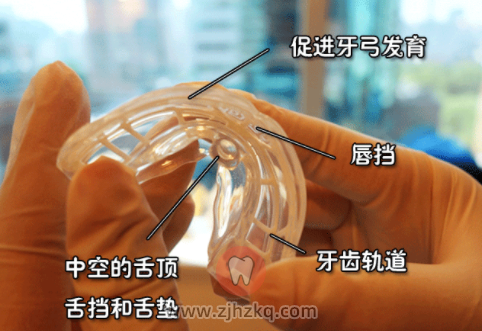 杭州MRC儿童正畸矫正器