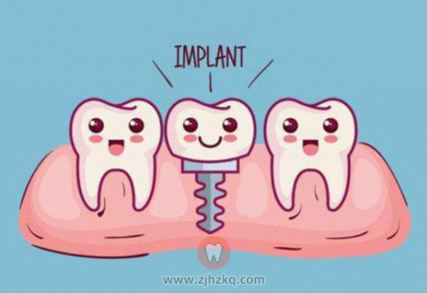 六个种植牙灵魂拷问