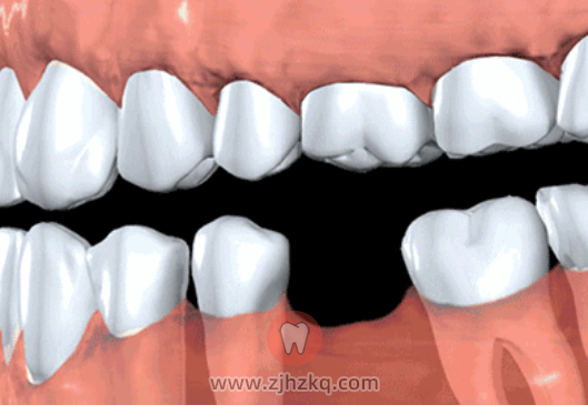 杭州口腔舒适化治疗