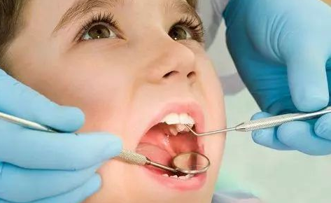 杭州学生看牙攻略