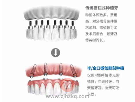 杭州康源口腔看牙记
