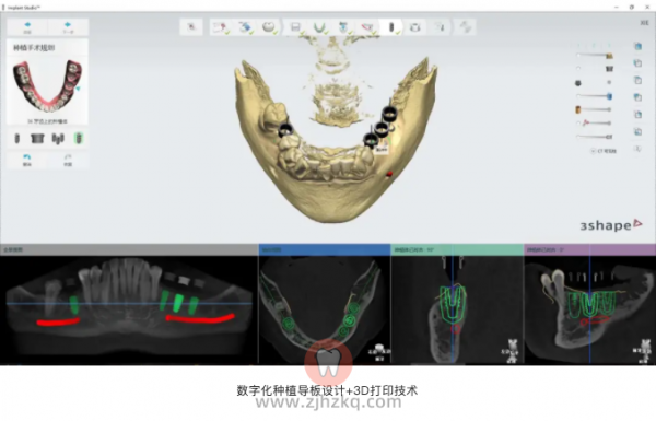 杭州康源口腔看牙记