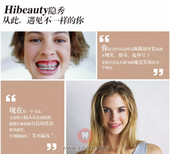 隐秀牙套官方介绍
