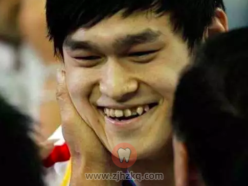 孙杨整牙医院曝光