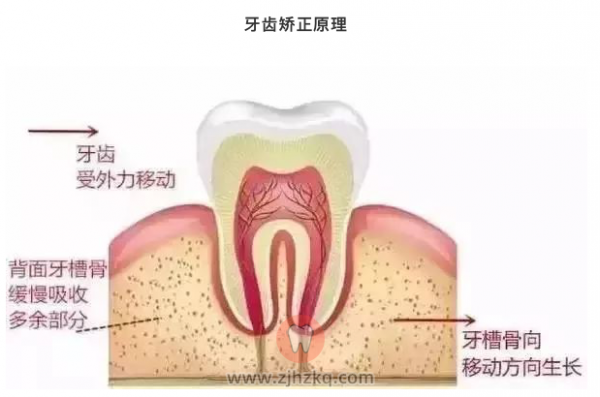 牙齿矫正危害风险