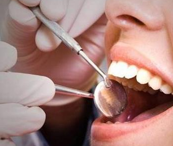 杭州洗牙过程视频