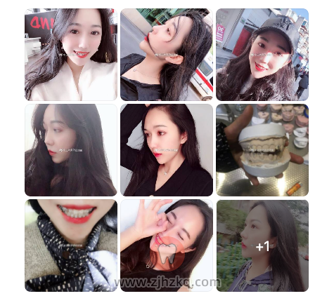 杭州正畸私人诊所公立医院