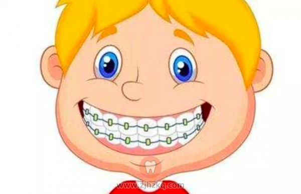 杭州儿童牙齿矫正最佳年龄