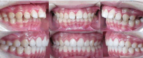 杭州雅莱齿科正畸水平怎么样