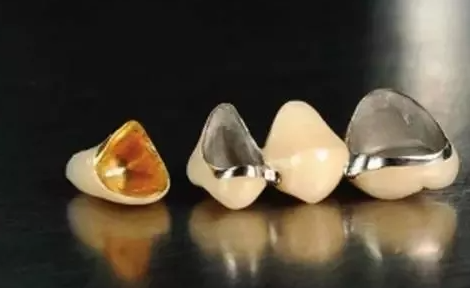 杭州种植牙品牌有哪些怎么选？