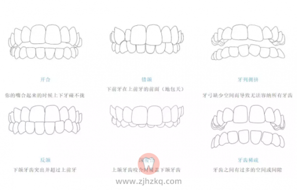 杭州专业靠谱的牙齿矫正医生求推荐？