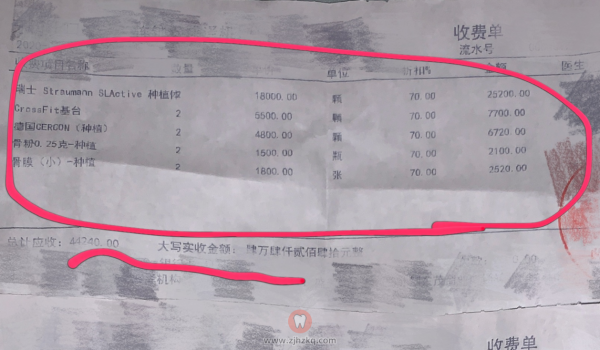 分享自己的瑞士iti种牙价格表含种植体牙冠基台价格