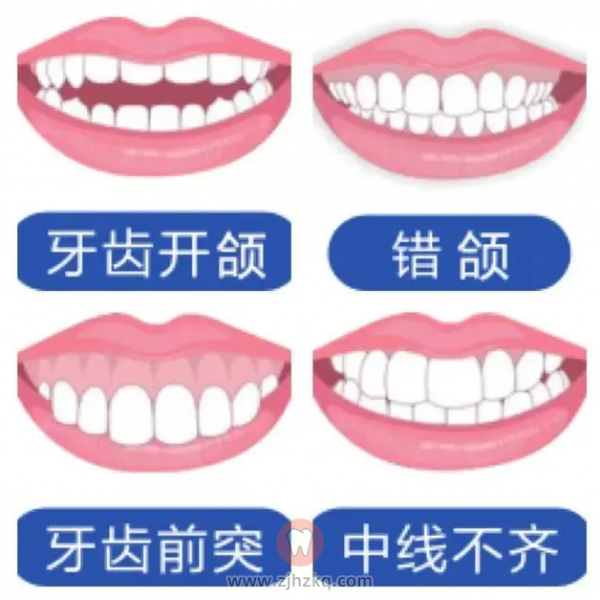 杭州牙齿矫正最佳年龄几岁越小越好吗？
