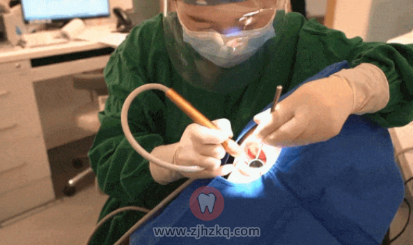 杭州牙科医院洗牙怎么样好不好？