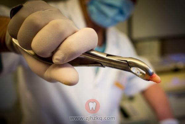 到底什么人不能不适合拔牙？