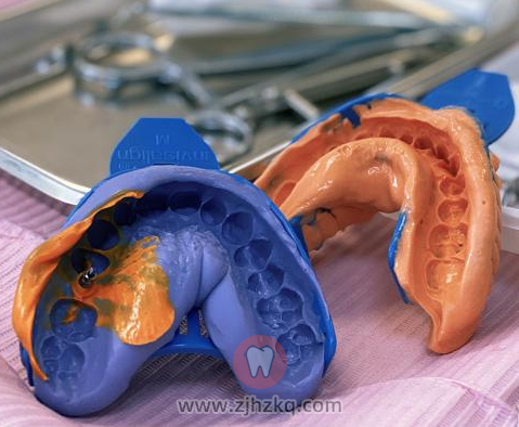 一般杭州的口腔医院都是怎么种牙的？