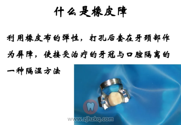 看牙时放进嘴巴里的橡皮障是干嘛用的？