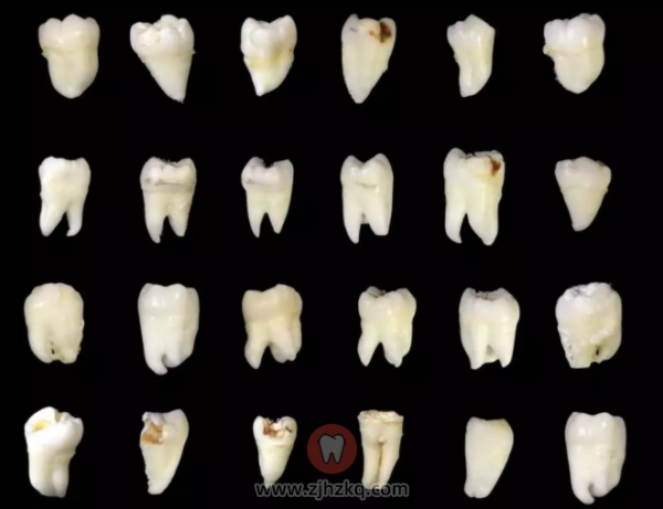 杭州拔牙价格为什么这么贵？解密！