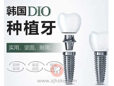 韩国DIO种植体价格7000元贵吗？
