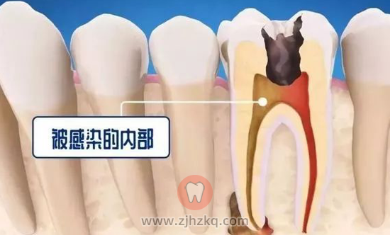 为什么要定期口腔检查