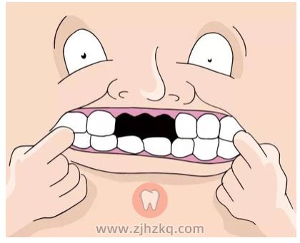 为什么医生说冬天是种牙的好时机