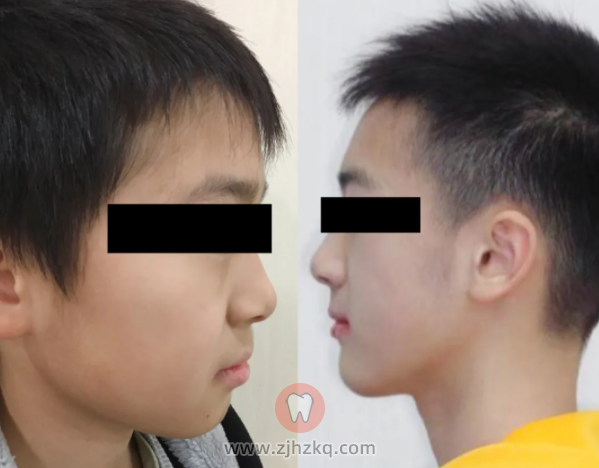 杭州雅莱口腔正畸院长纪亚梅水平怎么样？