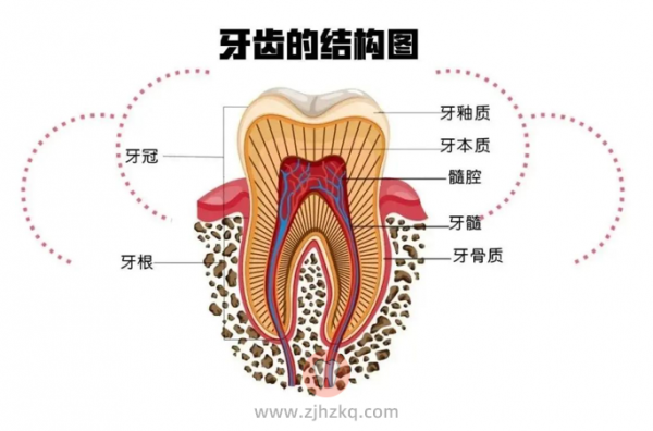 早期龋齿症状图片