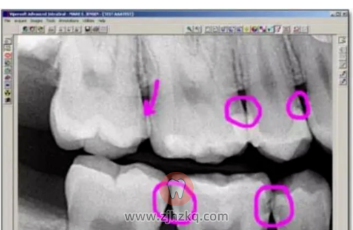 杭州口腔检查都检查什么？