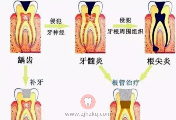 杭州口腔检查都检查什么？