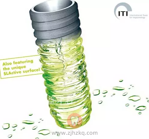 杭州种植牙价格参考表