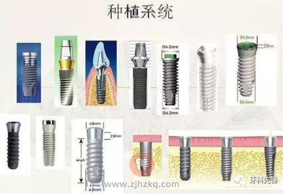 为什么杭州种植牙价格这么贵？