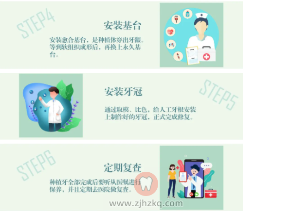 种植牙种牙过程图片