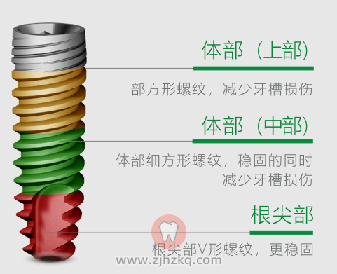 德国卡瓦ABT种植体官方介绍