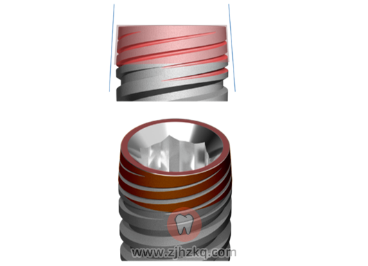 德国卡瓦ABT种植体官方介绍
