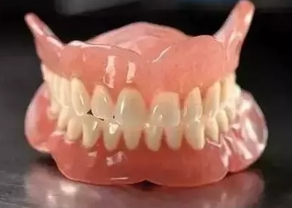 全口bps吸附性义齿多少钱？