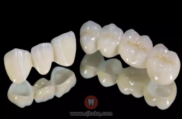 全瓷牙图片